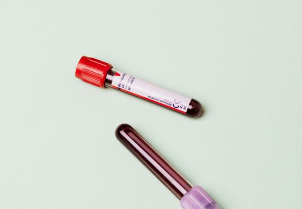 як підвищити гемоглобін фото